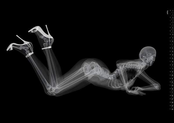 Eizo XRay PinUp Calendar