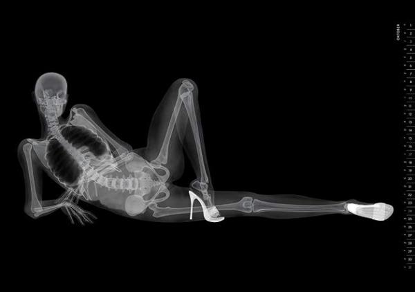 Eizo XRay PinUp Calendar