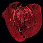 Cara-Barer-heart 2