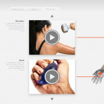 Smart Orthopedic Cast 3